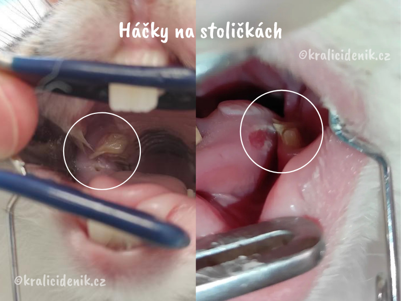 háčky na stoličkách